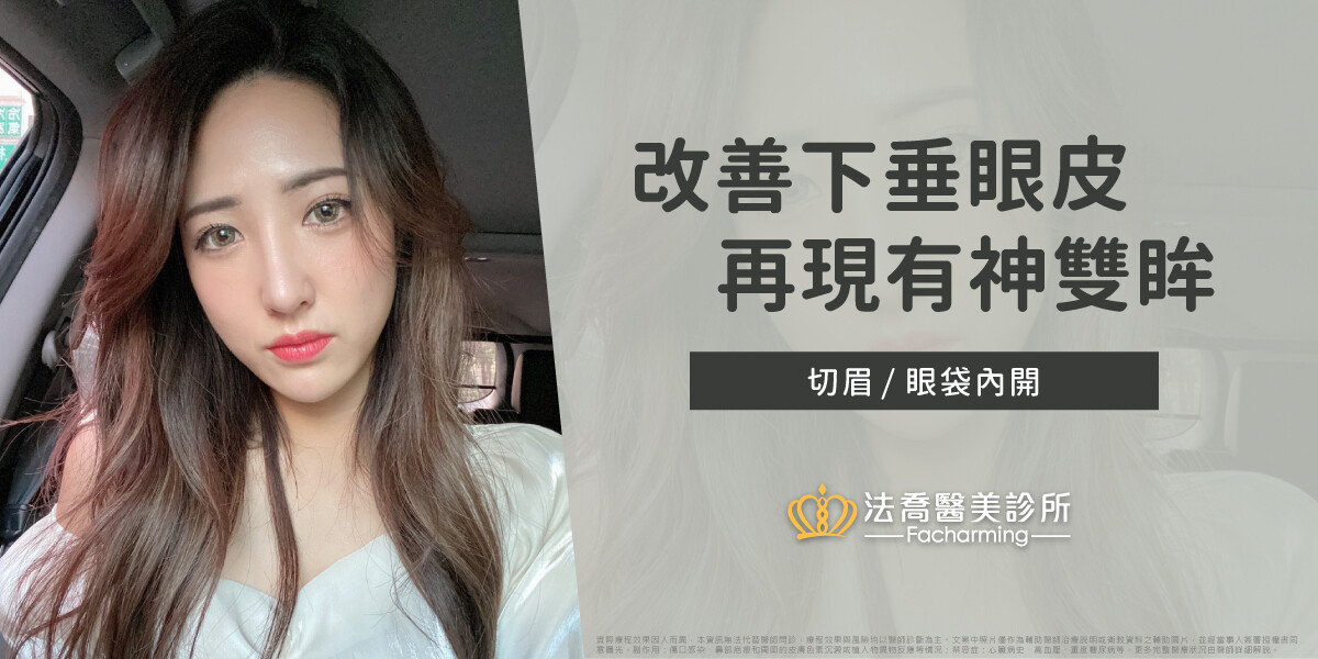 眼袋內開+切眉 韓國人妻重現亮眼