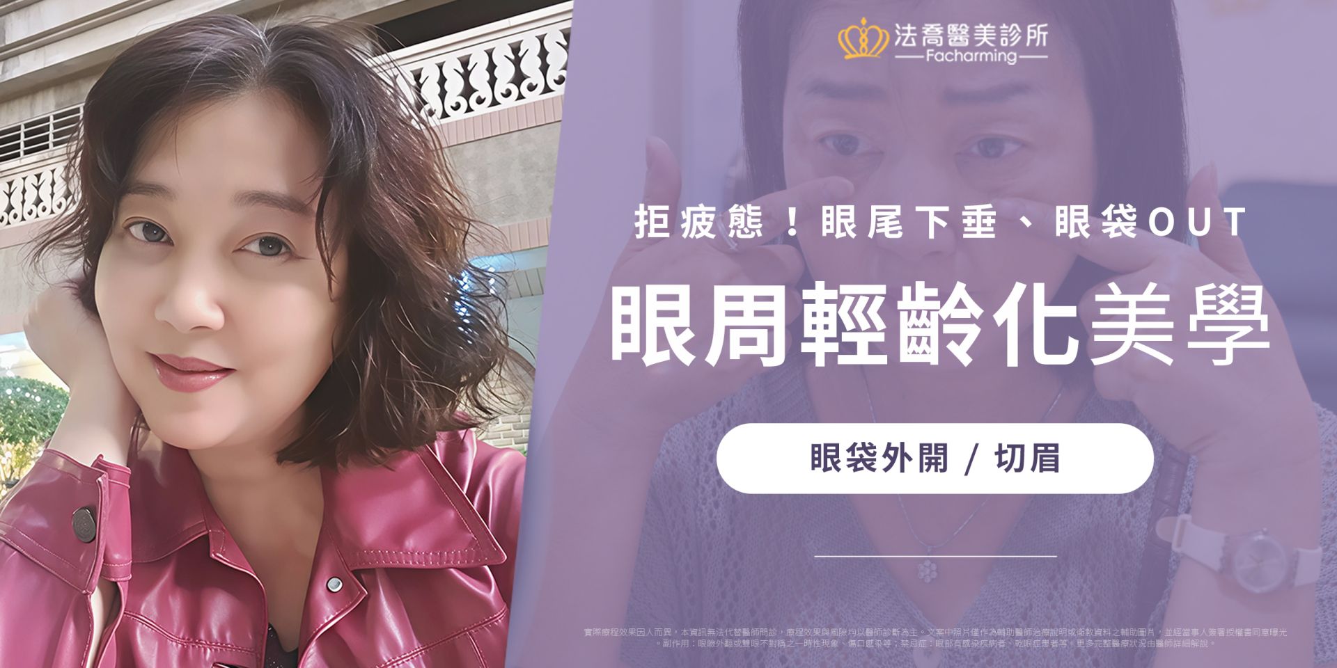 《乙瑄》眼袋外開/切眉