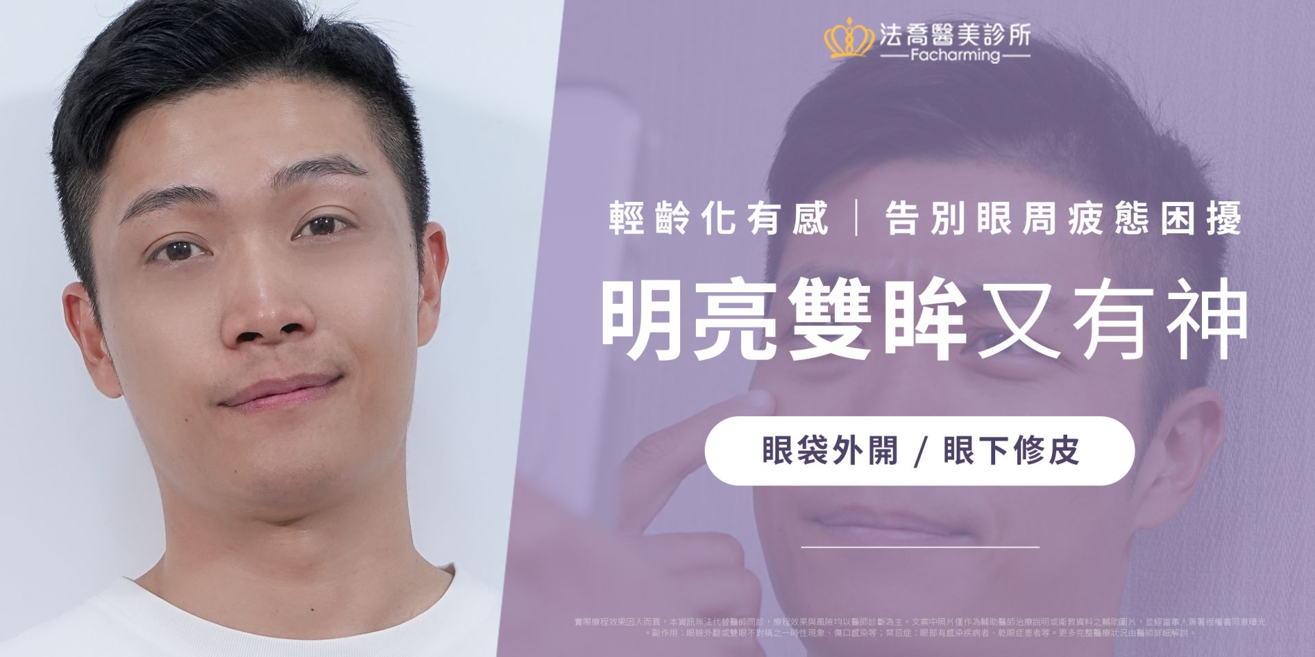 《Lulu》眼袋外開